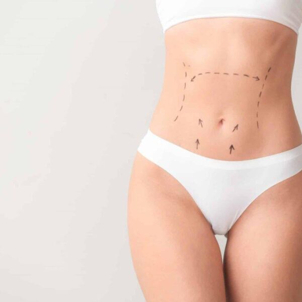 fat transfer in dubai