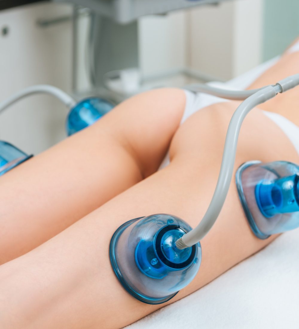 wood therapy before and after